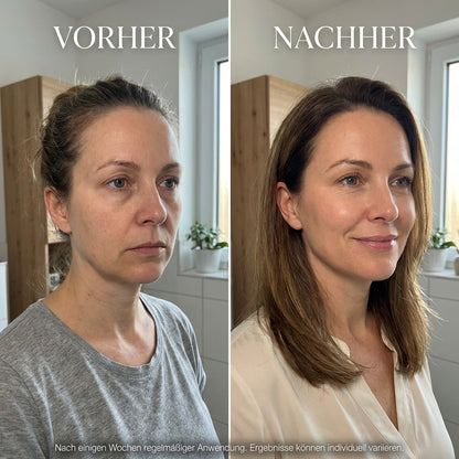 Vyra Lift | DEIN GLOW-RITUAL